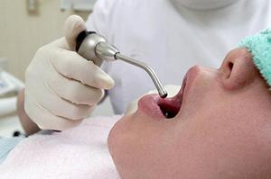 出っ歯の矯正をするなら美容専門の歯科を