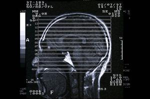 静岡市で見つかる！コスパ重視の矯正歯科ガイド2026